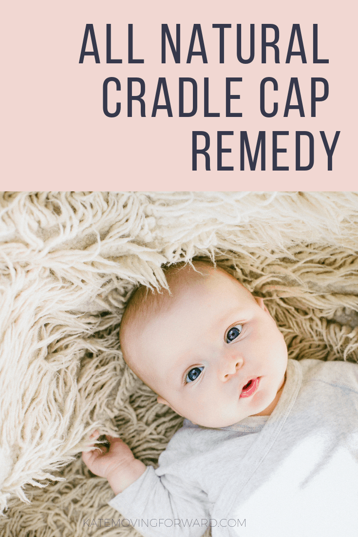 All Natural Cradle Cap Remedy